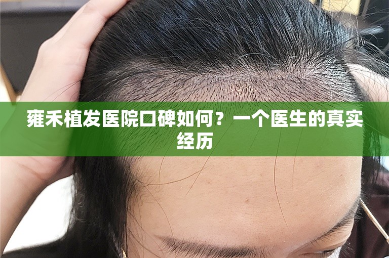 雍禾植发医院口碑如何？一个医生的真实经历