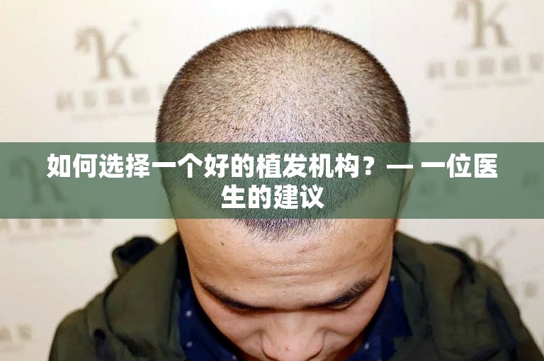 如何选择一个好的植发机构？— 一位医生的建议