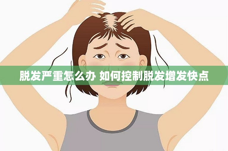 脱发严重怎么办 如何控制脱发增发快点