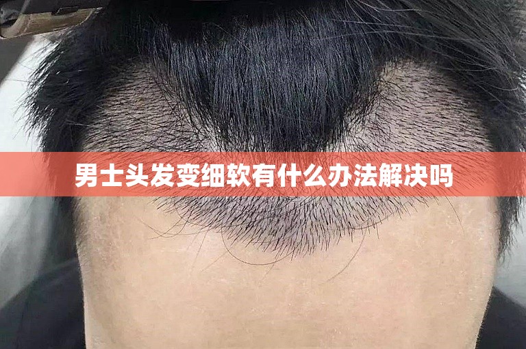 男士头发变细软有什么办法解决吗