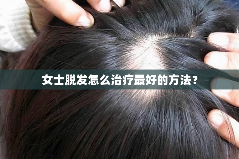 女士脱发怎么治疗最好的方法？