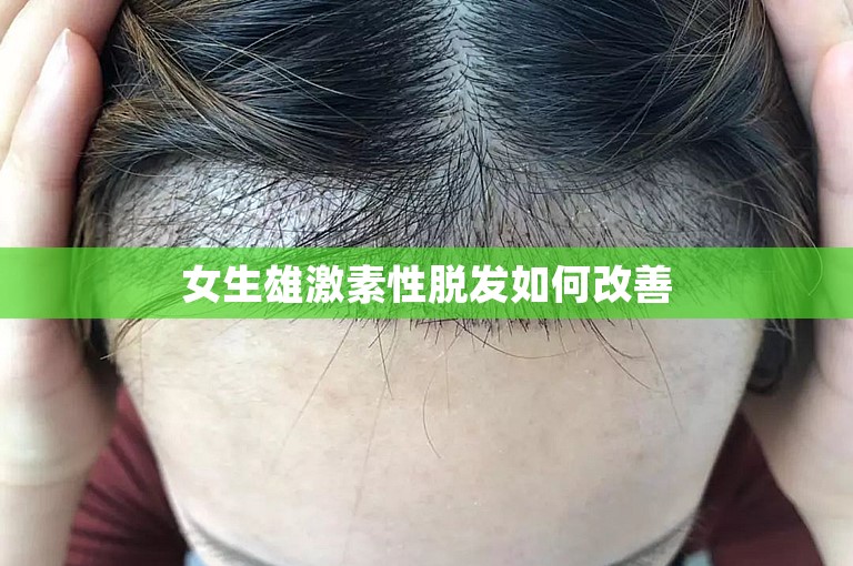 女生雄激素性脱发如何改善