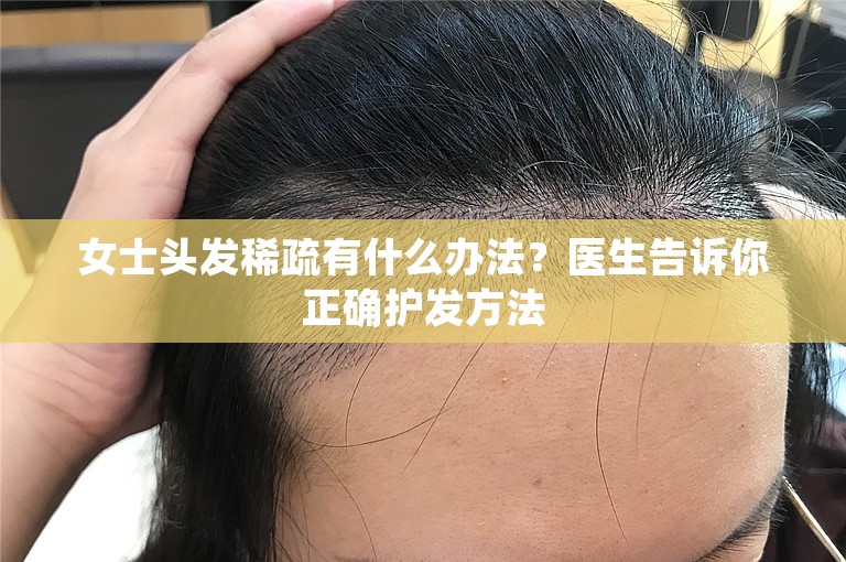 女士头发稀疏有什么办法？医生告诉你正确护发方法