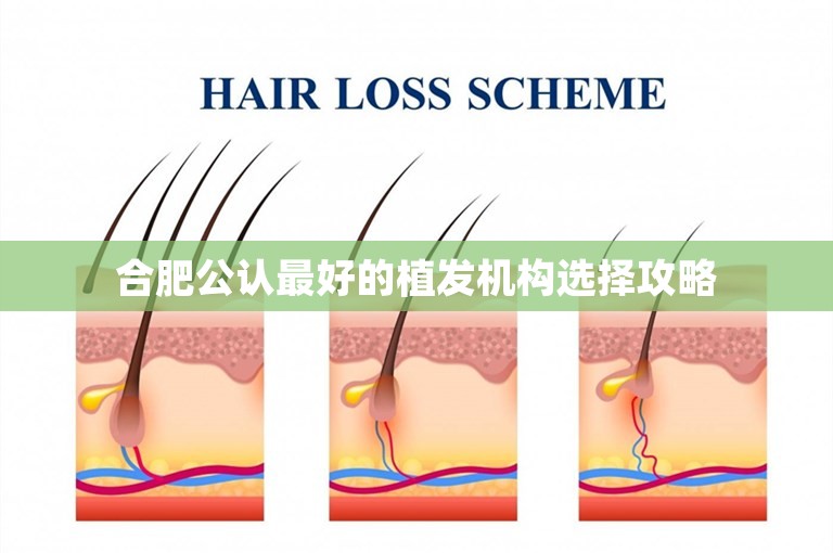 合肥公认最好的植发机构选择攻略