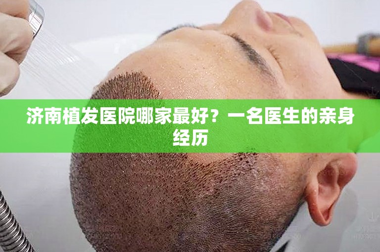 济南植发医院哪家最好？一名医生的亲身经历