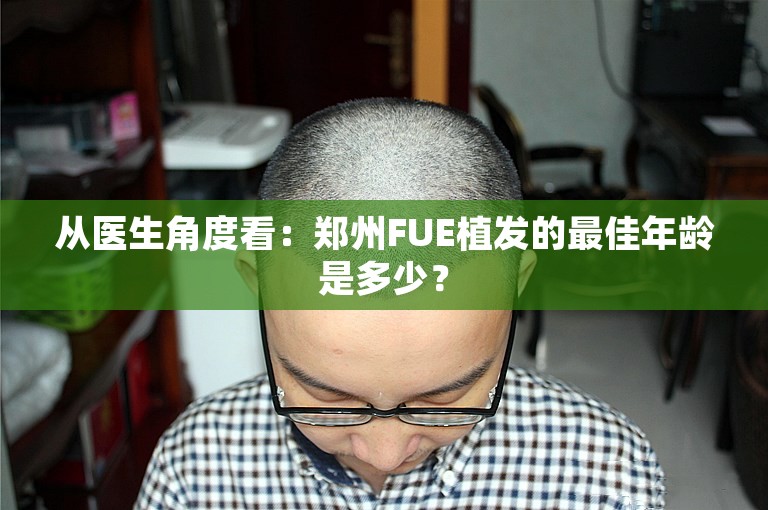 从医生角度看：郑州FUE植发的最佳年龄是多少？