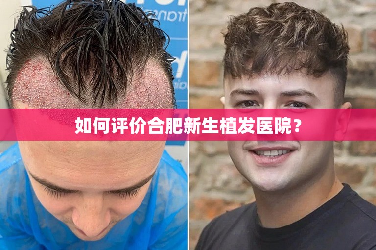 如何评价合肥新生植发医院？