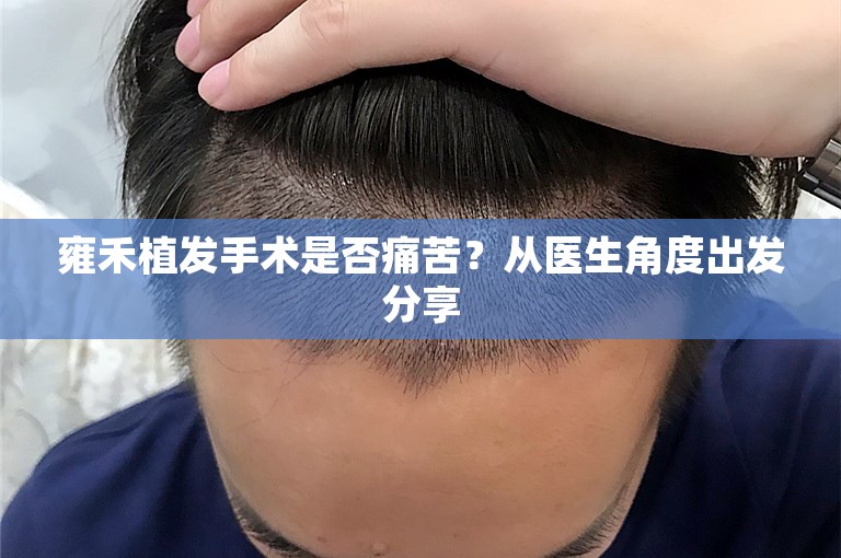 雍禾植发手术是否痛苦？从医生角度出发分享