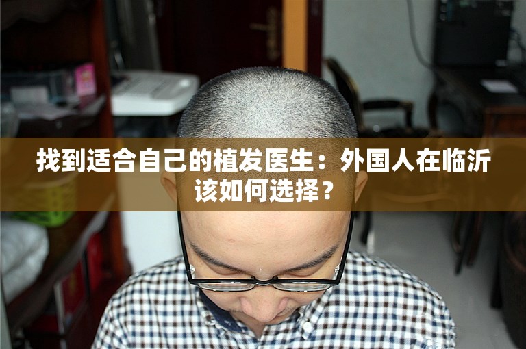 找到适合自己的植发医生：外国人在临沂该如何选择？