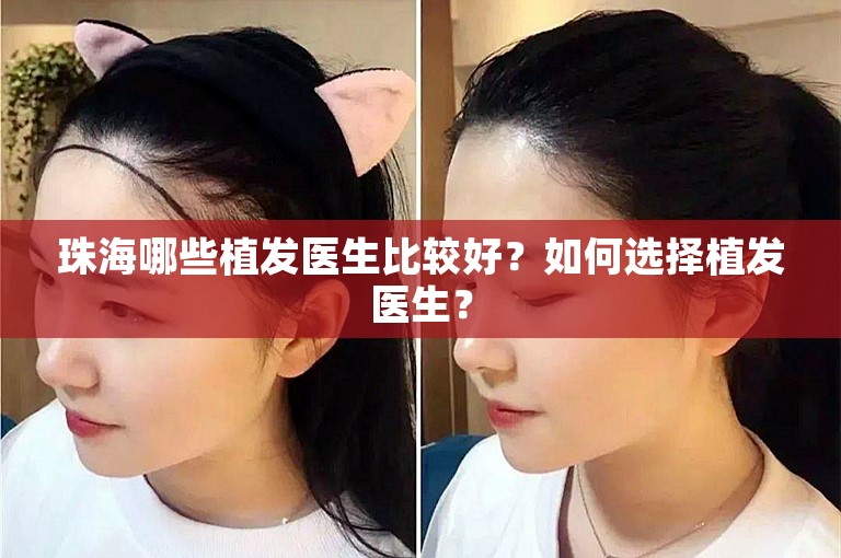 珠海哪些植发医生比较好？如何选择植发医生？