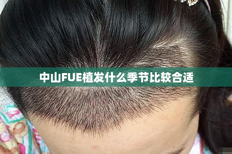 中山FUE植发什么季节比较合适