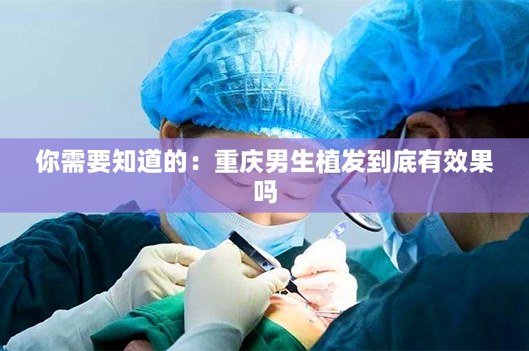 你需要知道的：重庆男生植发到底有效果吗