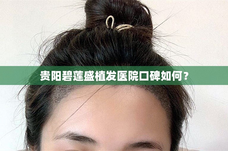 贵阳碧莲盛植发医院口碑如何？