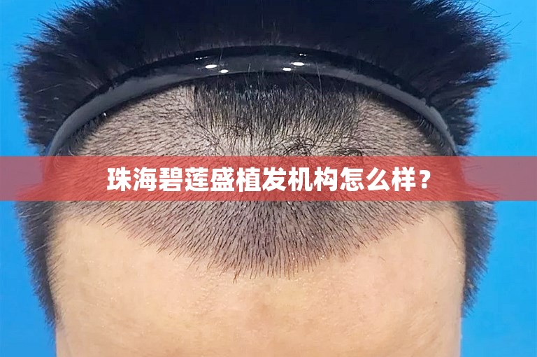 珠海碧莲盛植发机构怎么样？