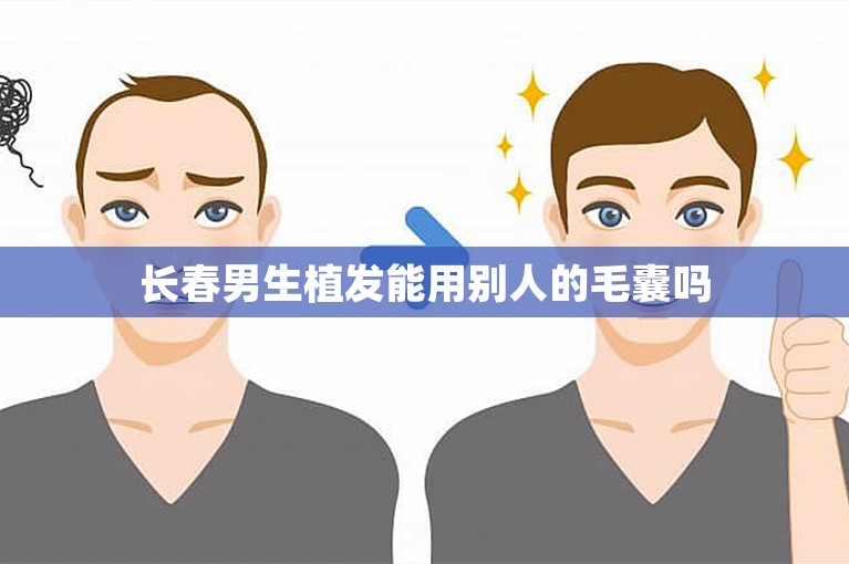 长春男生植发能用别人的毛囊吗