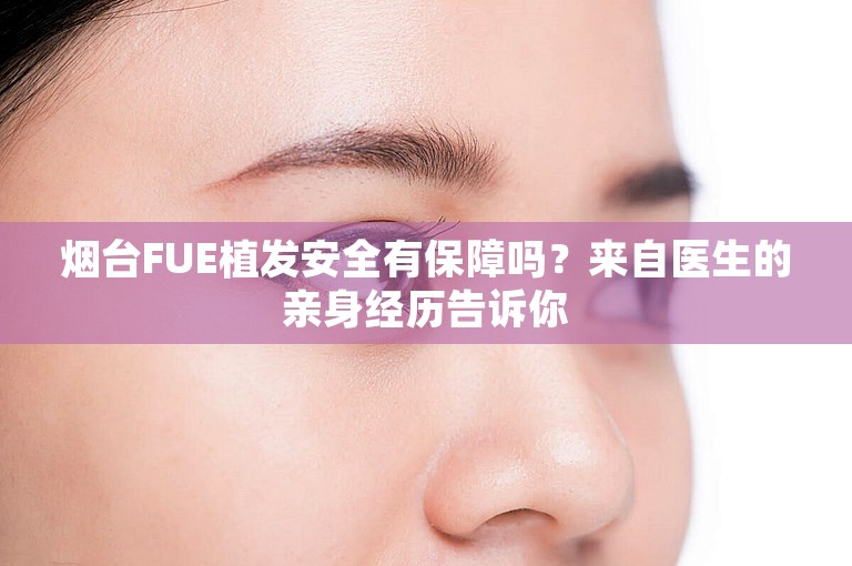 烟台FUE植发安全有保障吗？来自医生的亲身经历告诉你