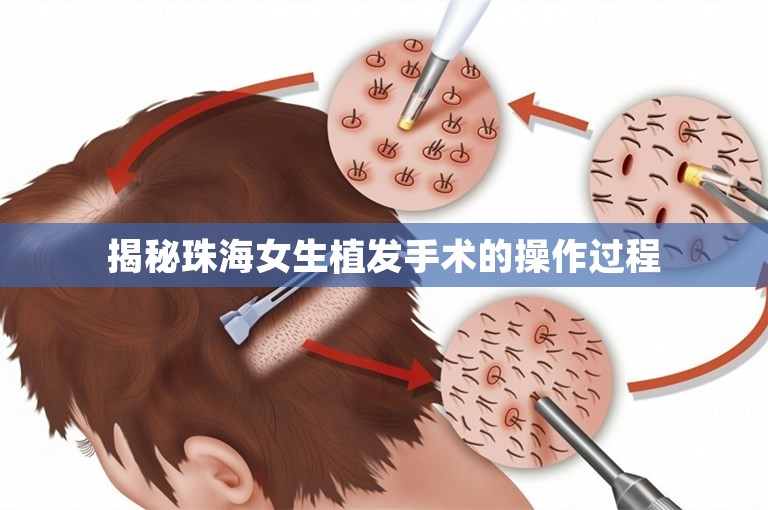 揭秘珠海女生植发手术的操作过程