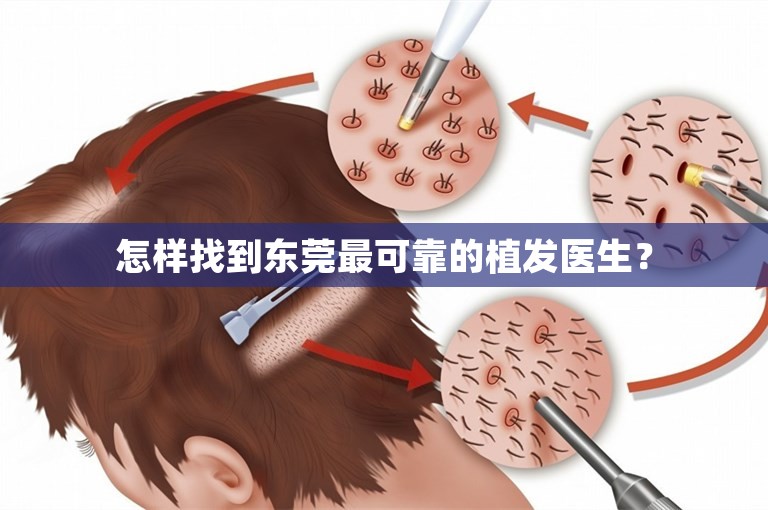 怎样找到东莞最可靠的植发医生？