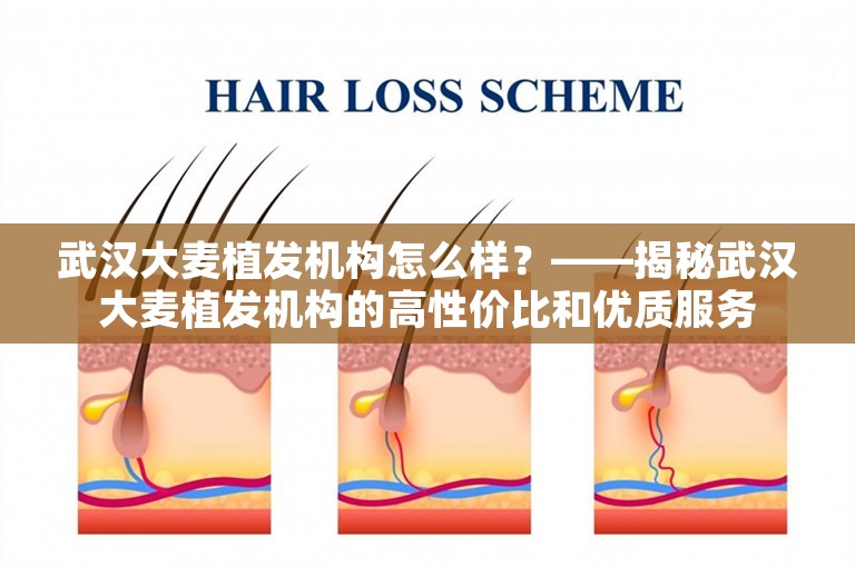 武汉大麦植发机构怎么样？——揭秘武汉大麦植发机构的高性价比和优质服务