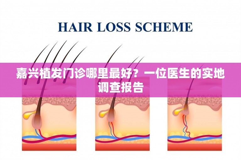 嘉兴植发门诊哪里最好？一位医生的实地调查报告