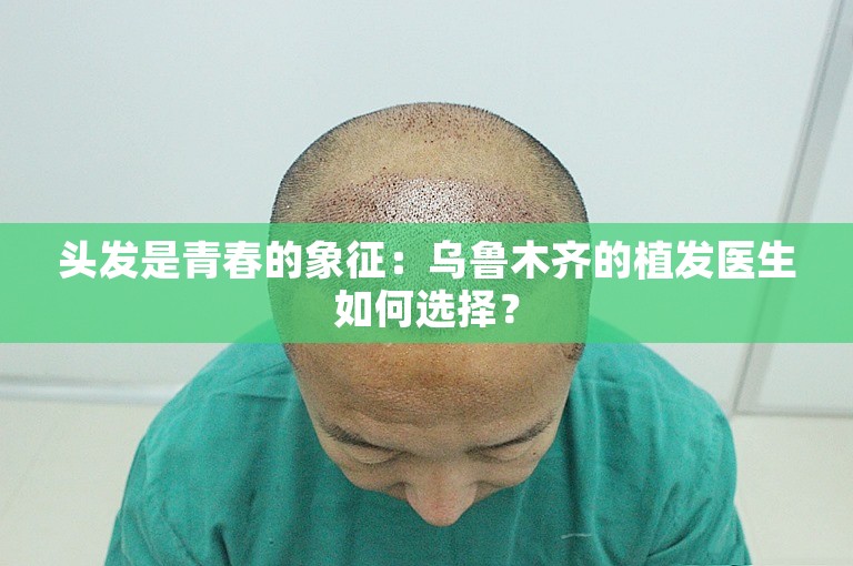 头发是青春的象征：乌鲁木齐的植发医生如何选择？