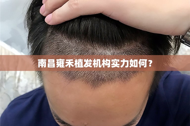 南昌雍禾植发机构实力如何？