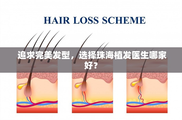  追求完美发型，选择珠海植发医生哪家好？