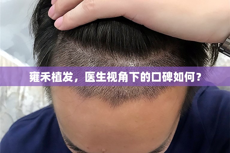 雍禾植发，医生视角下的口碑如何？