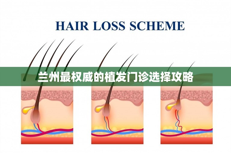 兰州最权威的植发门诊选择攻略