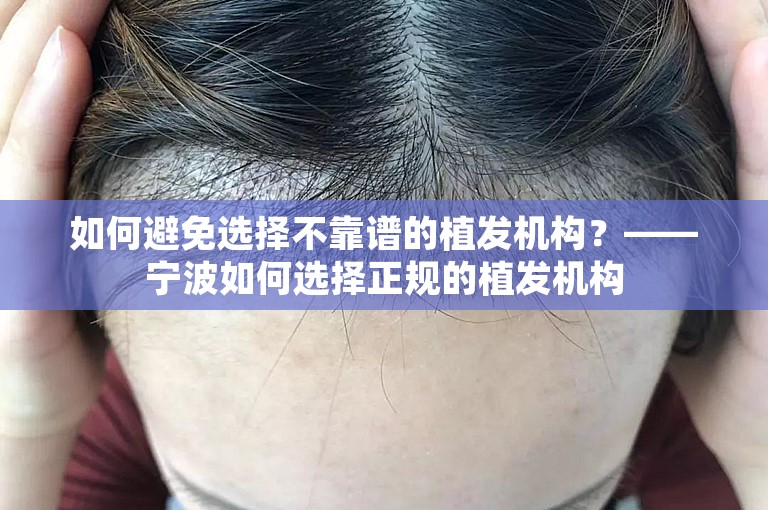 如何避免选择不靠谱的植发机构？——宁波如何选择正规的植发机构