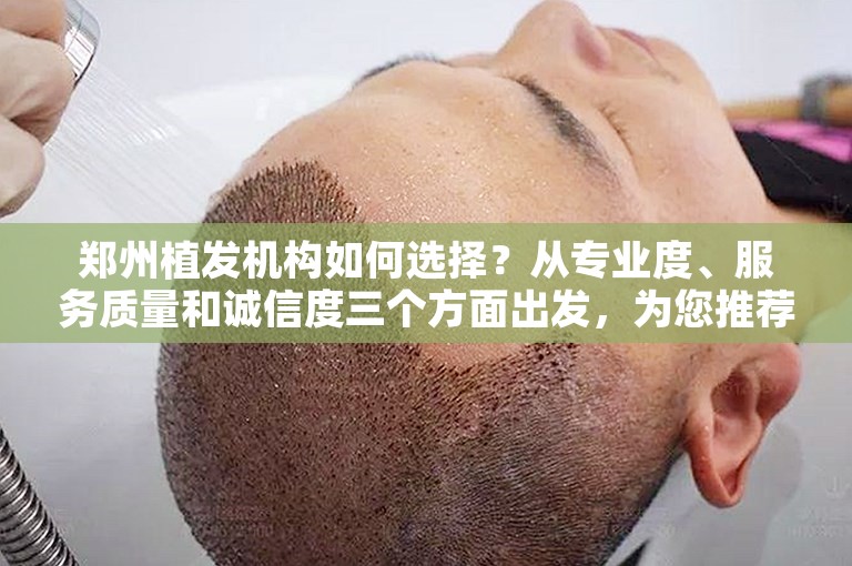 郑州植发机构如何选择？从专业度、服务质量和诚信度三个方面出发，为您推荐三家口碑良好的植发机构。