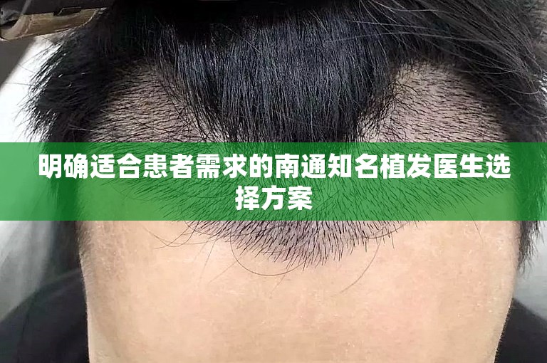 明确适合患者需求的南通知名植发医生选择方案