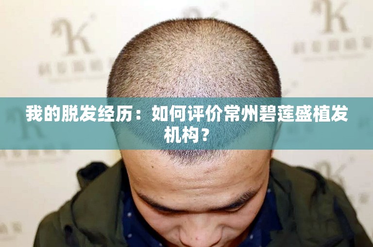 我的脱发经历：如何评价常州碧莲盛植发机构？