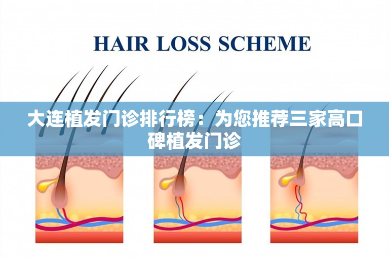 大连植发门诊排行榜：为您推荐三家高口碑植发门诊