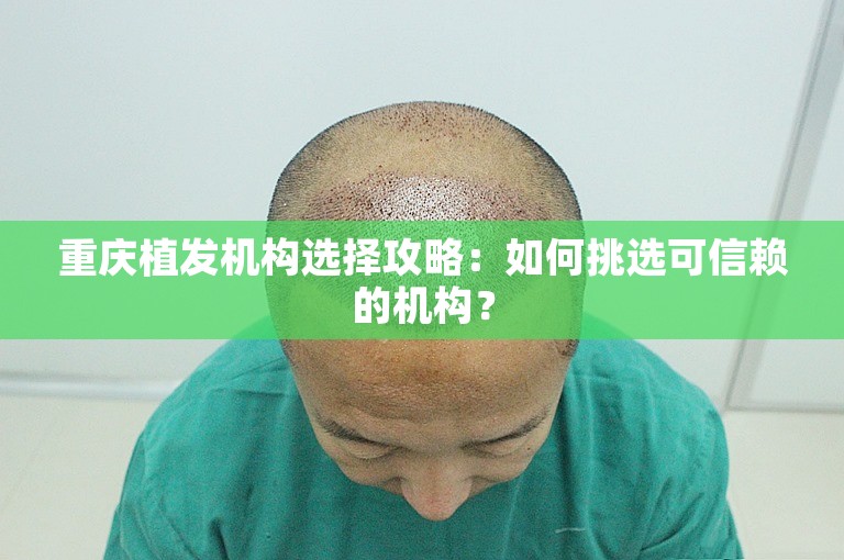 重庆植发机构选择攻略：如何挑选可信赖的机构？