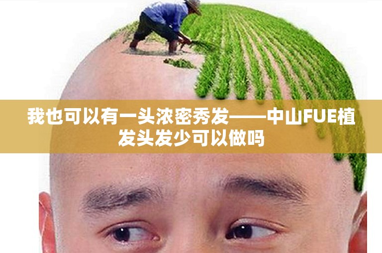 我也可以有一头浓密秀发——中山FUE植发头发少可以做吗