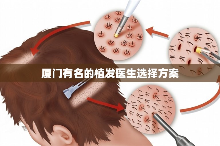 厦门有名的植发医生选择方案