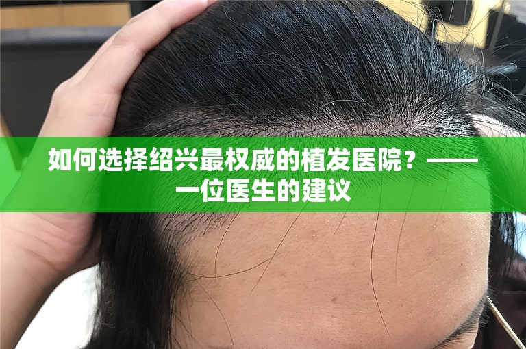 如何选择绍兴最权威的植发医院？——一位医生的建议