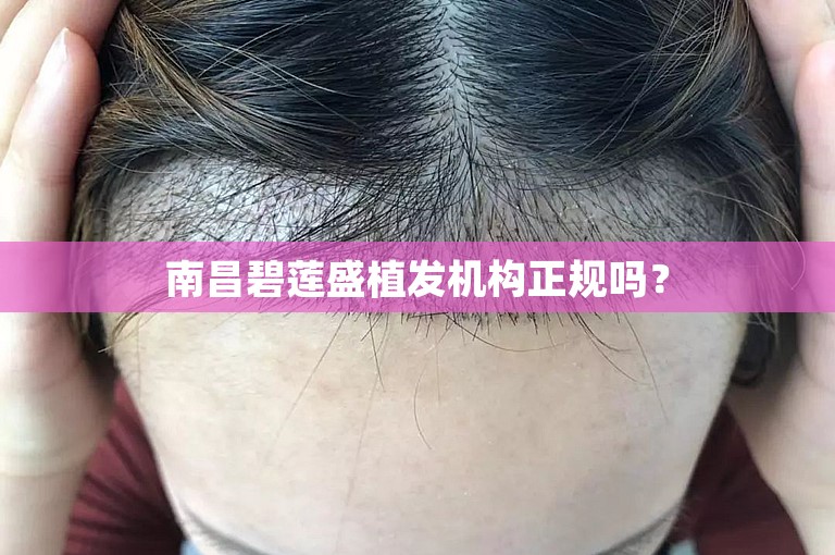 南昌碧莲盛植发机构正规吗？