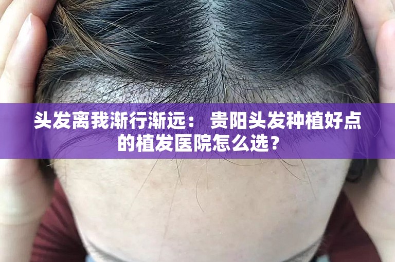 头发离我渐行渐远： 贵阳头发种植好点的植发医院怎么选？