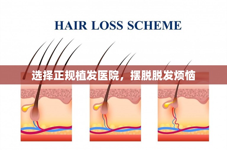 选择正规植发医院，摆脱脱发烦恼