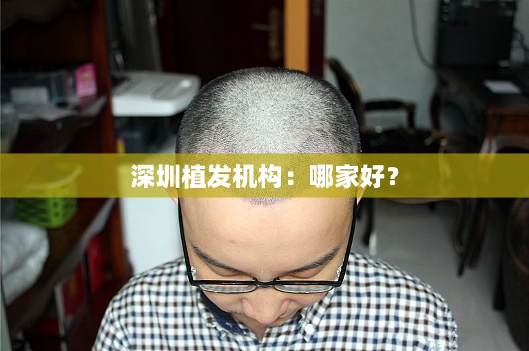 深圳植发机构：哪家好？