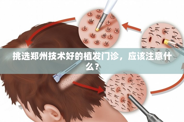 挑选郑州技术好的植发门诊，应该注意什么？