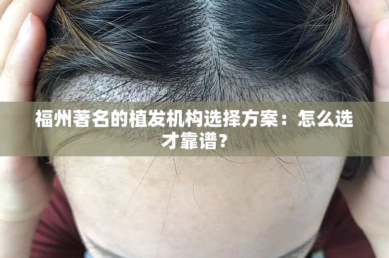 福州著名的植发机构选择方案：怎么选才靠谱？