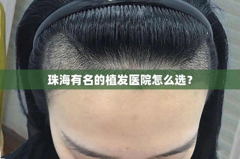 珠海有名的植发医院怎么选？