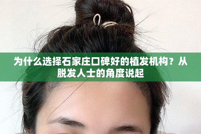 为什么选择石家庄口碑好的植发机构？从脱发人士的角度说起