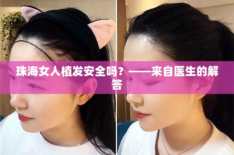 珠海女人植发安全吗？——来自医生的解答