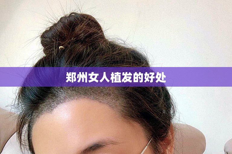 郑州女人植发的好处