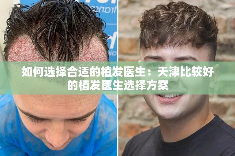 如何选择合适的植发医生：天津比较好的植发医生选择方案