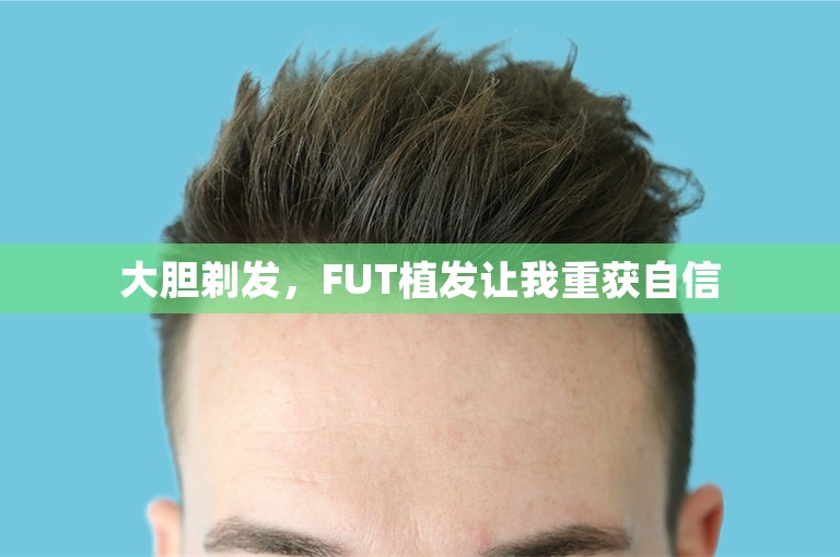 大胆剃发，FUT植发让我重获自信